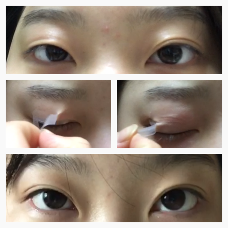 Optifold EyelidShaping™ Tapes (Standard Pack)
