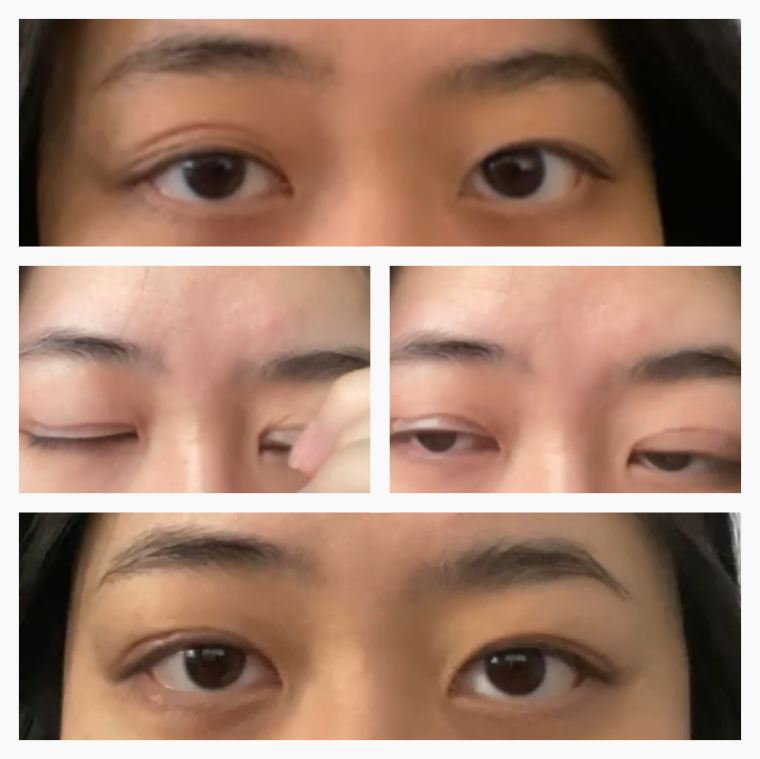 EyelidCare™: Monthly Consulting Subscription