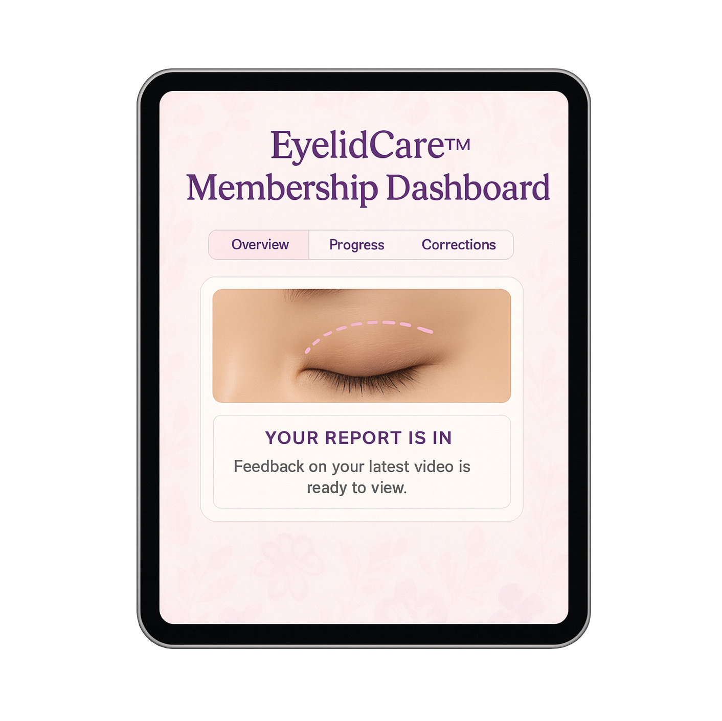 EyelidCare™: Monthly Consulting Subscription