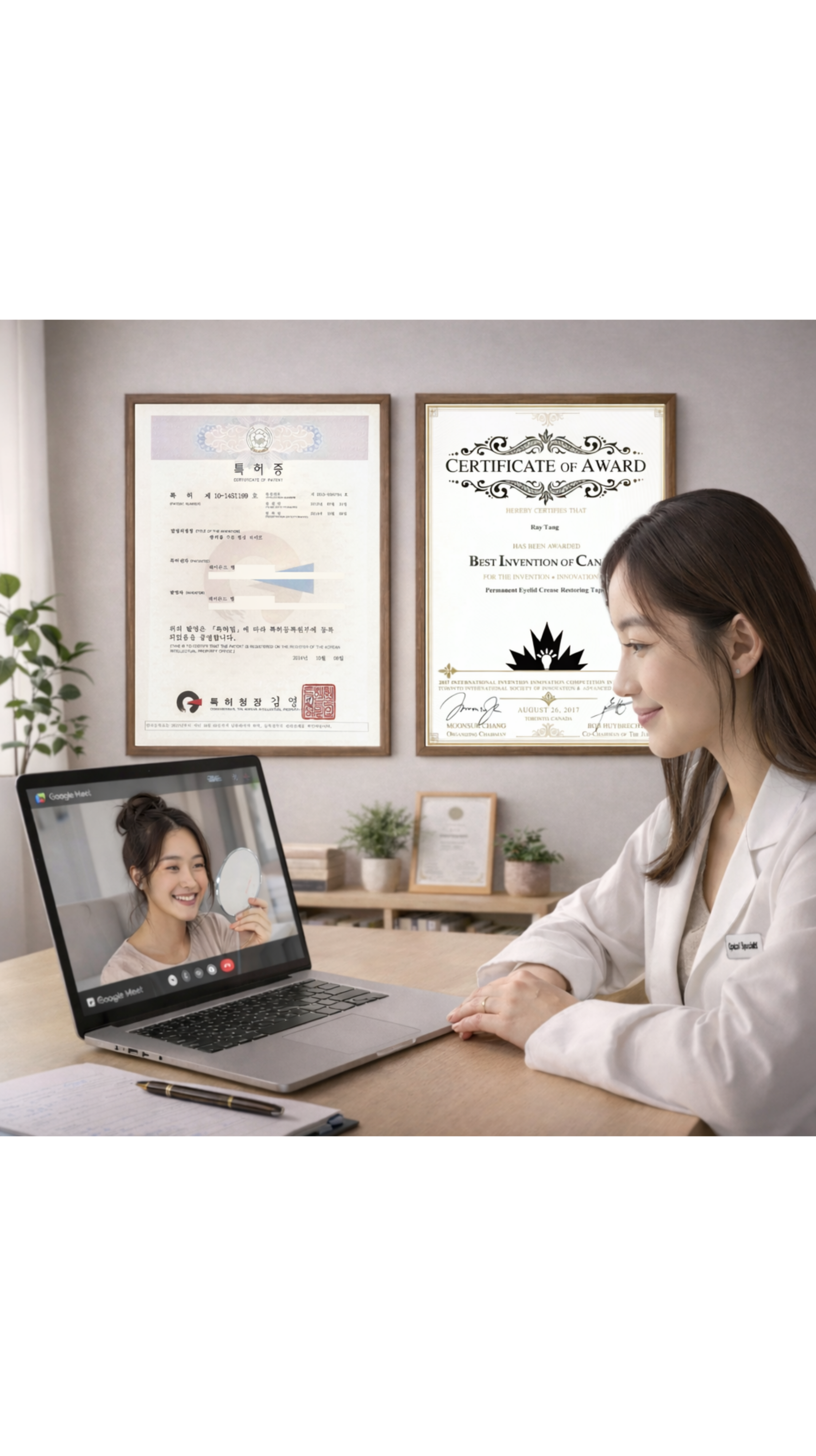 Guaranteed Double Eyelids – Personalized Advising Service – OPTIFOLD