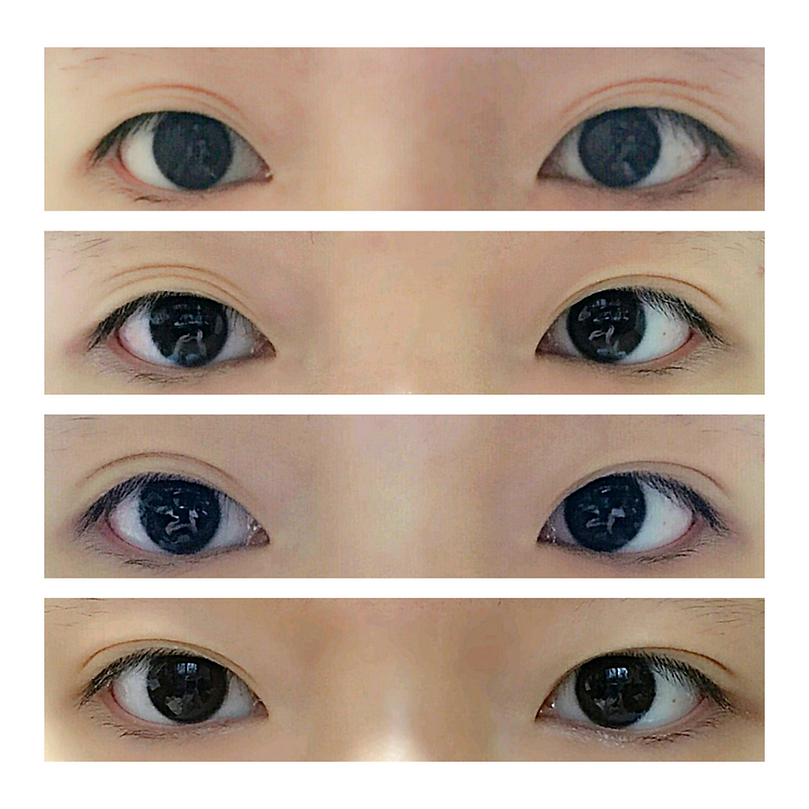 Optifold EyelidShaping™ Tapes (Standard Pack) +