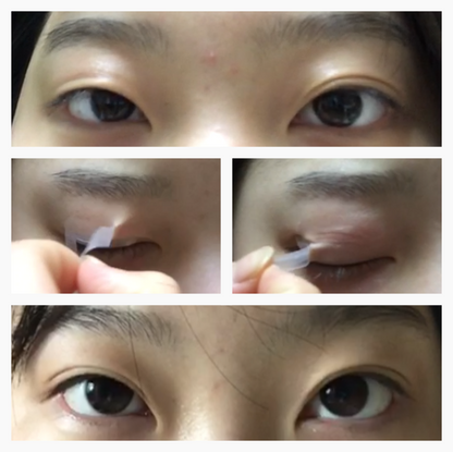 Optifold EyelidShaping™ Tapes (Standard Pack)