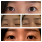 EyelidCare™: Monthly Consulting Subscription