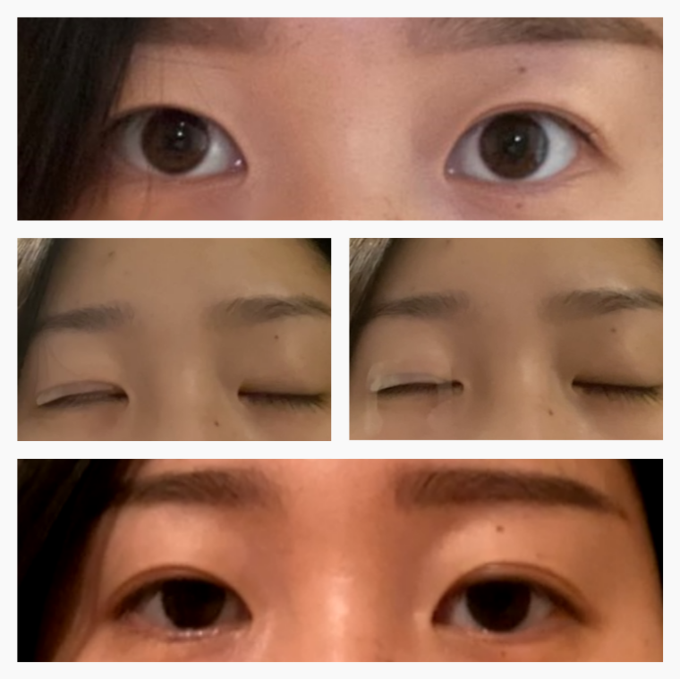 EyelidCare™: Monthly Consulting Subscription