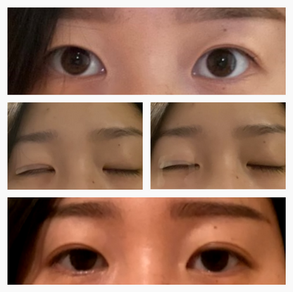 EyelidCare™: Monthly Consulting Subscription