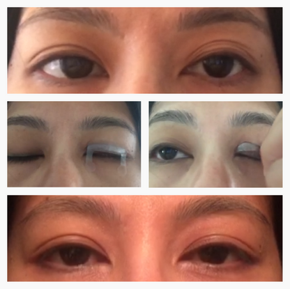 Optifold EyelidShaping™ Tapes (Standard Pack)