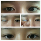 Optifold Eyelid Tapes - Create Double Eyelids + Fix Uneven, Droopy, Hooded Eyelids