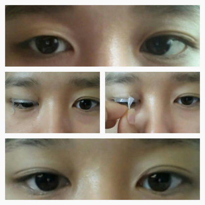 Optifold EyelidShaping™ Tapes (Standard Pack)