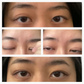 Optifold Eyelid Tapes - Create Double Eyelids + Fix Uneven, Droopy, Hooded Eyelids