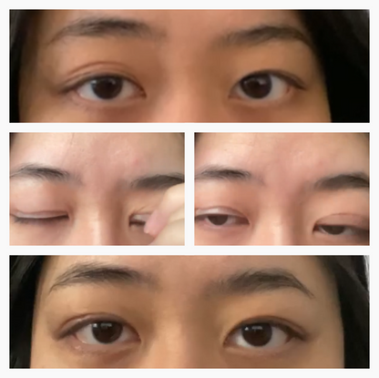 EyelidCare™: Monthly Consulting Subscription