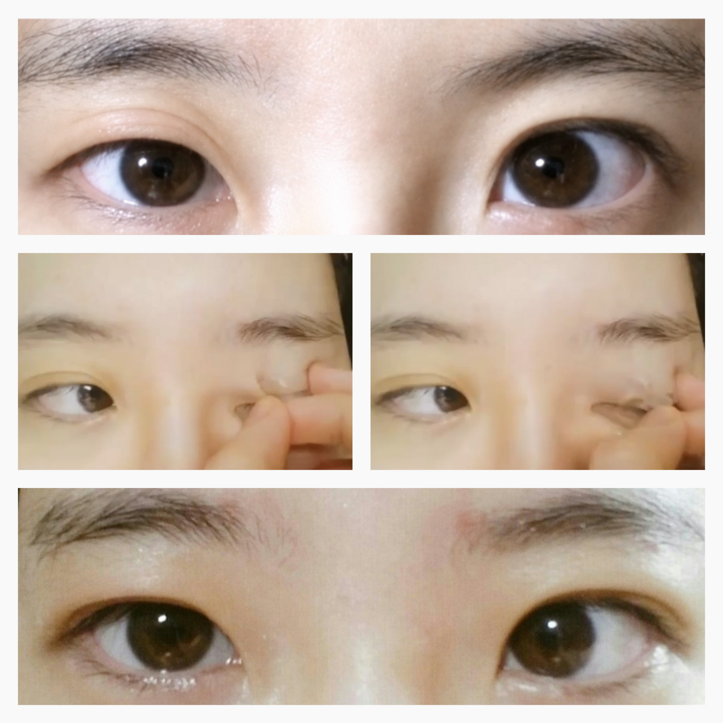 Optifold EyelidShaping™ Tapes (Standard Pack)