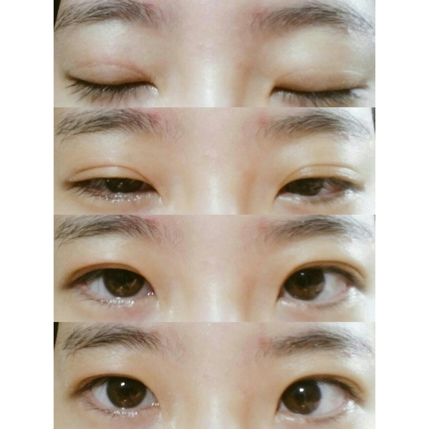 Optifold EyelidShaping™ Tapes (Standard Pack)
