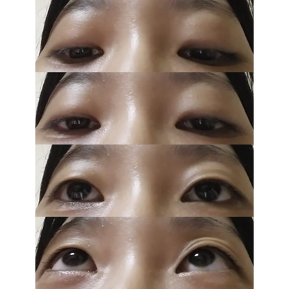 Optifold EyelidShaping™ Tapes (Standard Pack)