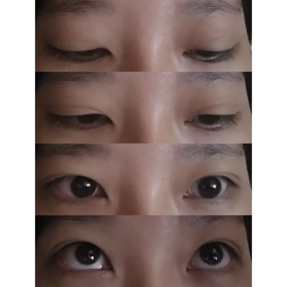 Optifold EyelidShaping™ Tapes (Standard Pack)