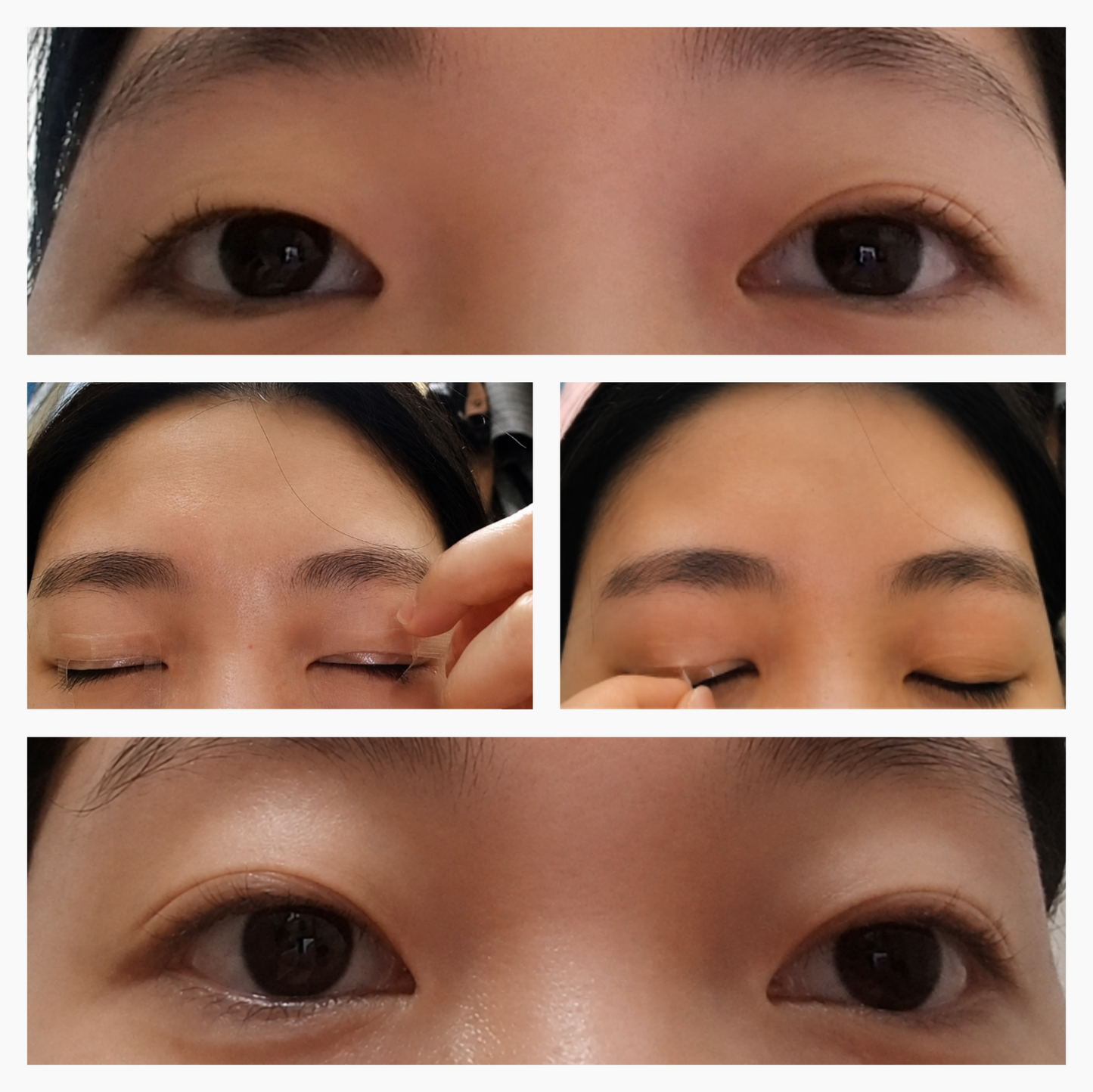 Optifold EyelidShaping™ Tapes (Standard Pack)