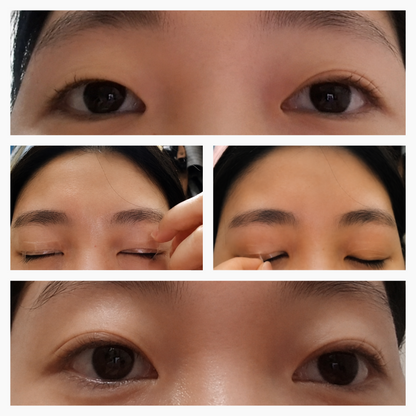 Optifold EyelidShaping™ Tapes (Standard Pack)