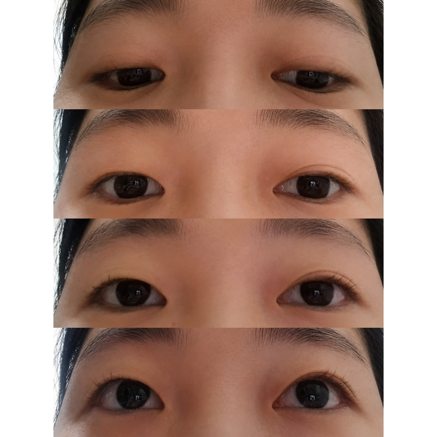 Optifold EyelidShaping™ Tapes (Standard Pack)