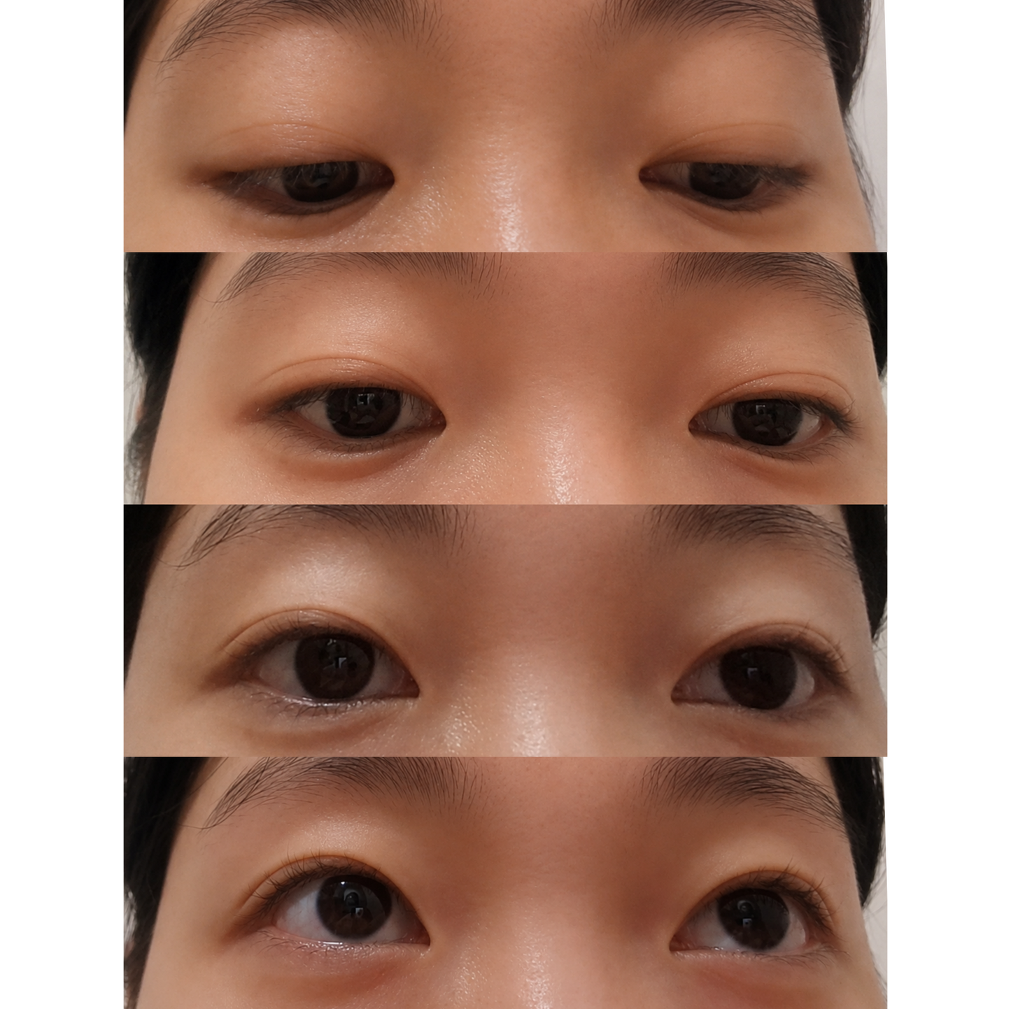 Optifold EyelidShaping™ Tapes (Standard Pack)