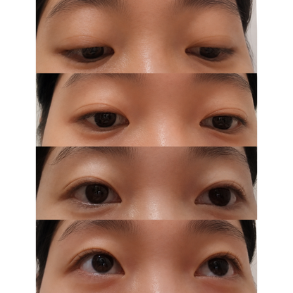 Optifold EyelidShaping™ Tapes (Standard Pack)