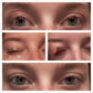 EyelidCare™: Monthly Consulting Subscription